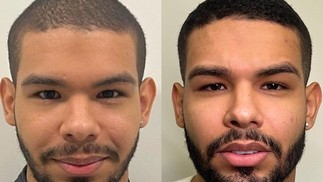 Antes e depois da harmonização facial de Vyni — Foto: Reprodução/Instagram