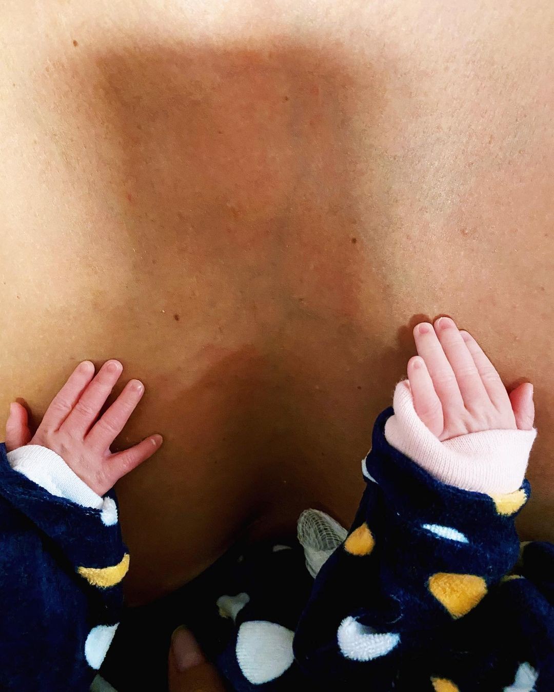 Marcella Fogaça mostra mãozinhas de filhas gêmas (Foto: Reprodução Instagram)