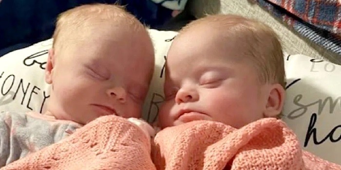 Gêmeas nascem com Síndrome de Down (Foto: Savannah Combs)