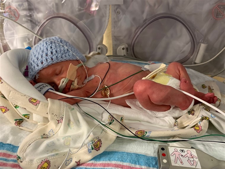 O pequeno Dylan na UTI Neonatal (Foto: Reprodução Facebook)