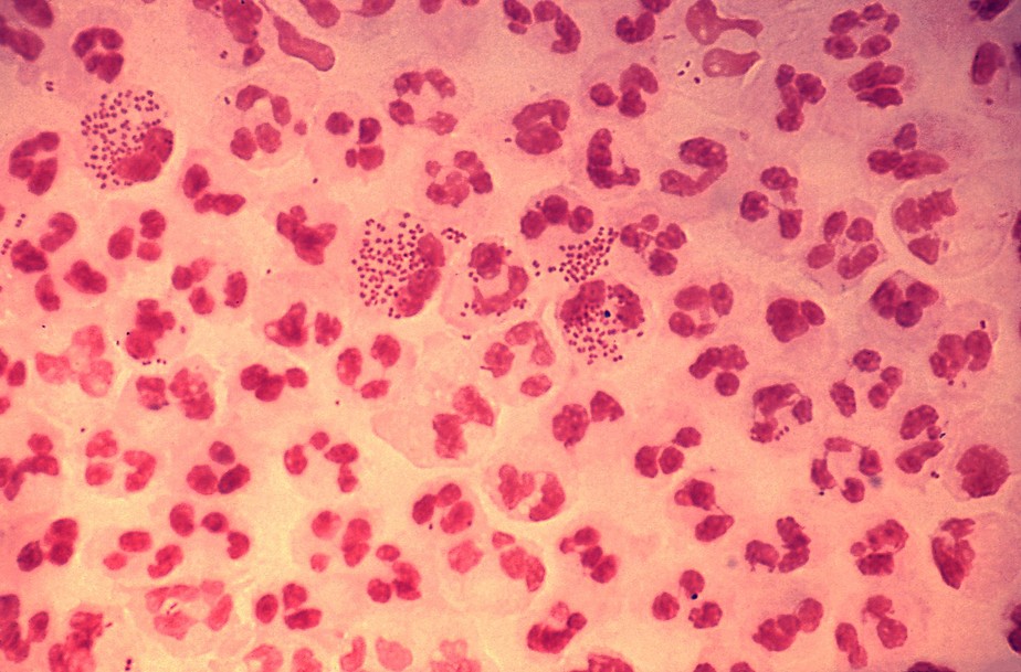 Bactéria 'Neisseria gonorrhoeae', causadora da gonorreia, infecção sexualmente transmissível