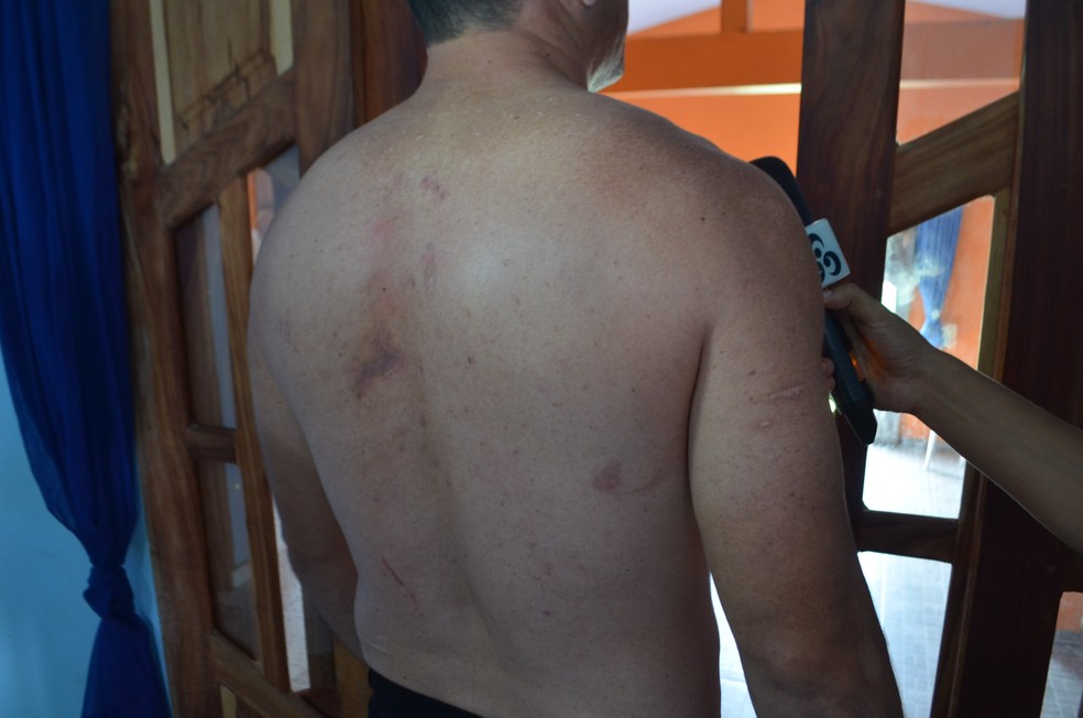 Paciente ouvido à época pelo G1 detalhou supostas agressões (Foto: Abinoan Santiago/Arquivo G1)