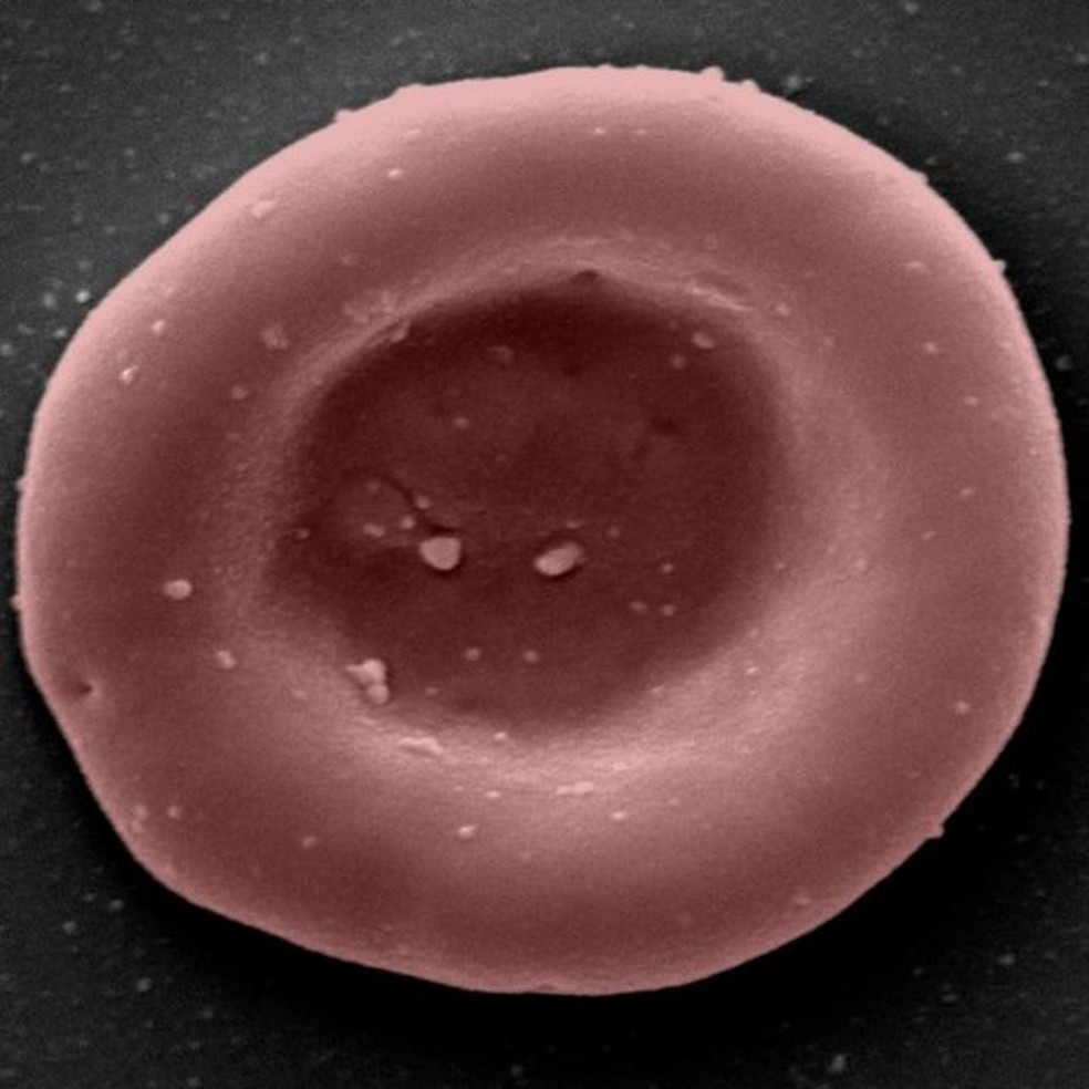 Um glóbulo vermelho cultivado em laboratório, que transporta oxigênio e dióxido de carbono ao redor do corpo — Foto: NHSBT/BBC