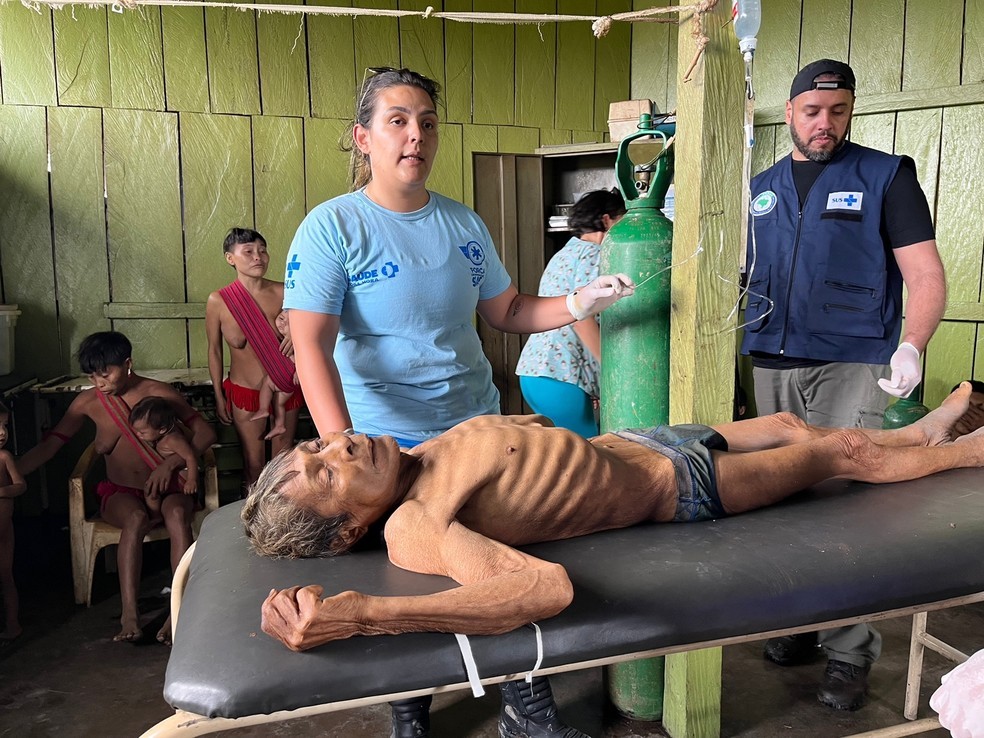 Indígena com desnutrição severa recebe atendimento de equipes do Ministério da Saúde — Foto: Divulgação/Condisi-YY 