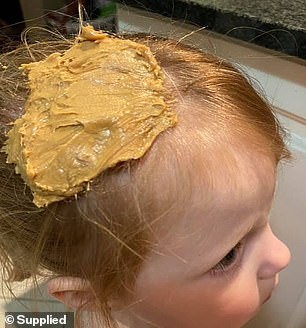 Mãe usa manteiga de amendoim para tirar chiclete do cabelo da filha (Foto: Reprodução/Daily Mail/Arquivo Pessoal)