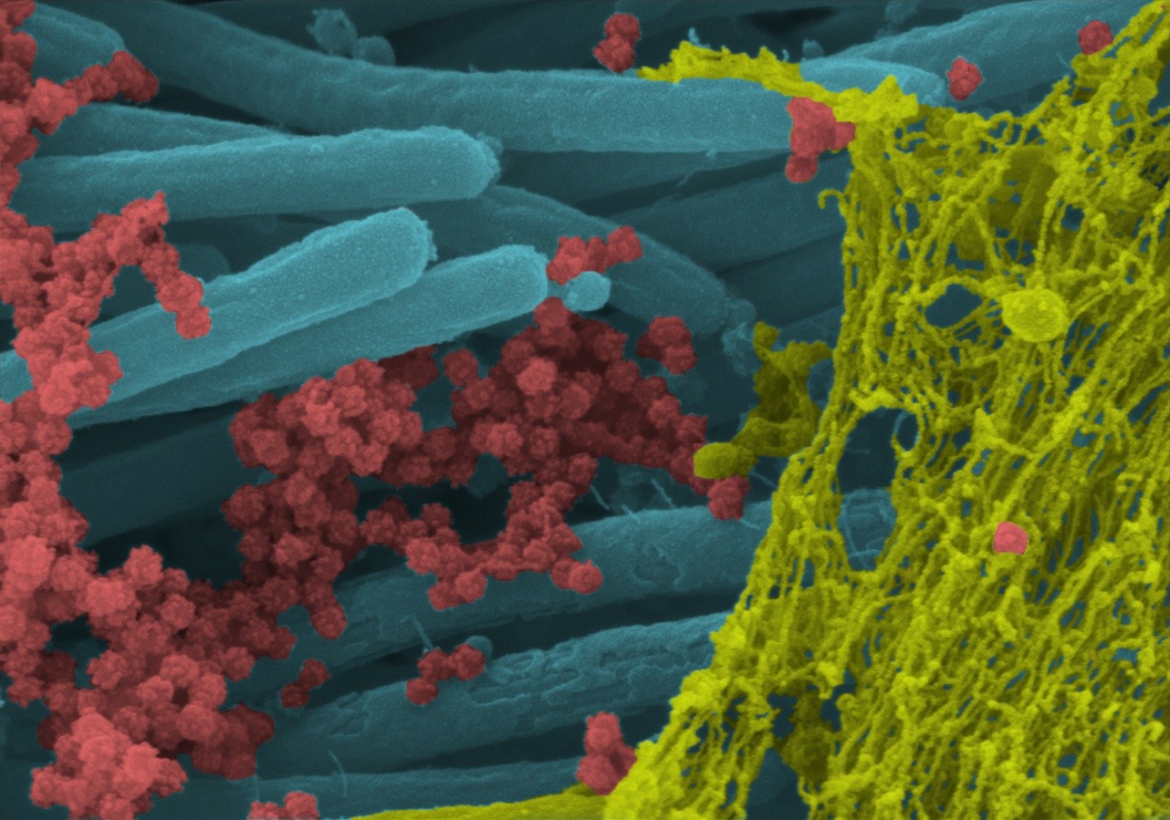 Vírions (vermelho) são as partículas do vírus responsáveis pela infecção (Foto: Ehre Lab, UNC School of Medicine)