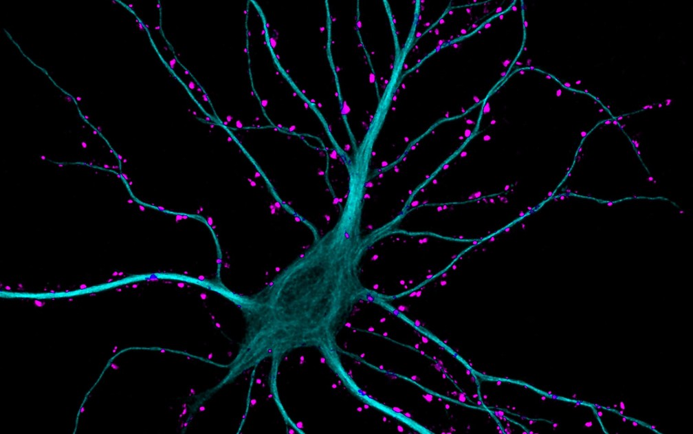 Neurônios do hipocampo recebendo estímulos. Região do cérebro associada à memória precisa conter substância inibitória para controle de pensamentos (Foto: Courtesy of Nikon Small World/ Dr. Kieran Boyle, University of Glasgow, Institute of Neuroscience and Psychology )