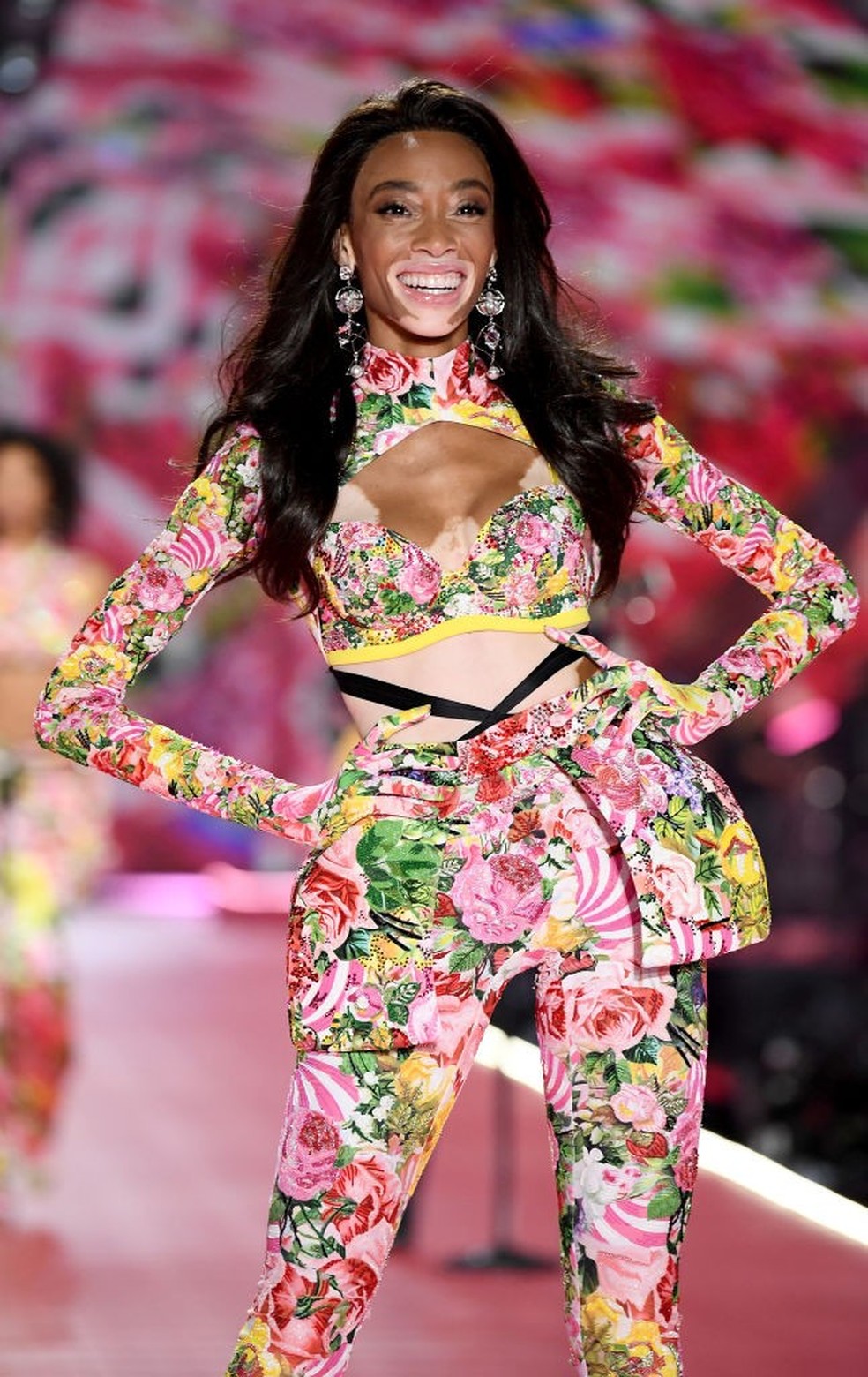 Total 88+ imagen modelo de victoria secret con manchas Abzlocal.mx
