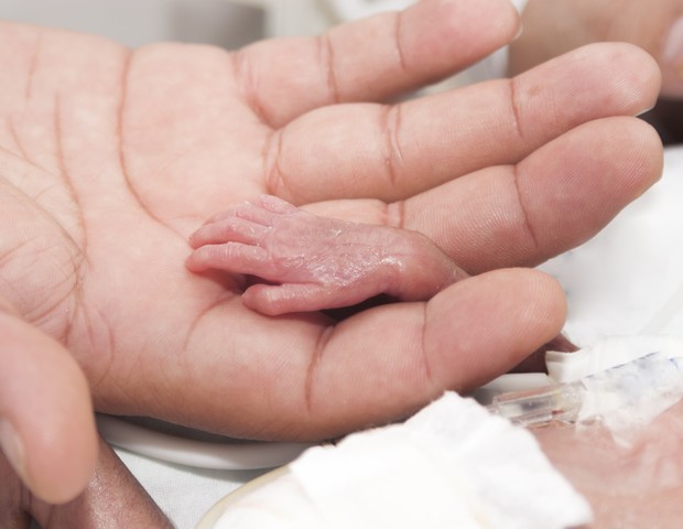 Hospital alcança excelentes resultados priorizando leite materno para micro-bebês (Foto: Thinkstock)