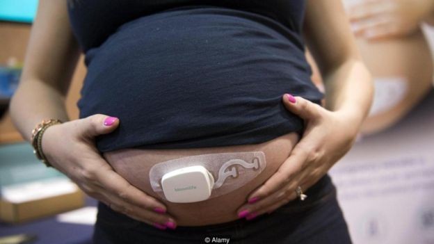 Os pais obcecados por dados podem começar a monitorar os bebês mesmo antes do nascimento (Foto: ALAMY via BBC)