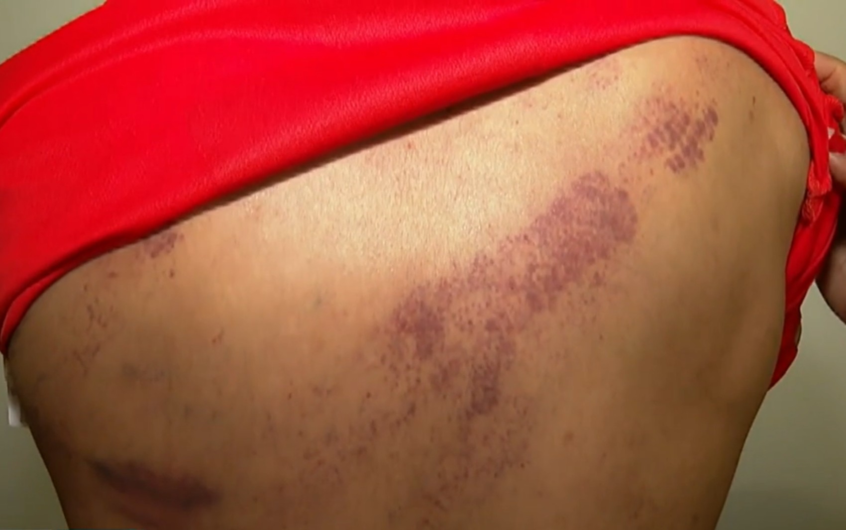 'Pulou em cima de mim e quebrou minha costela', diz jovem que afirma ter sido agredido por segurança do rodeio de Guaíra, SP