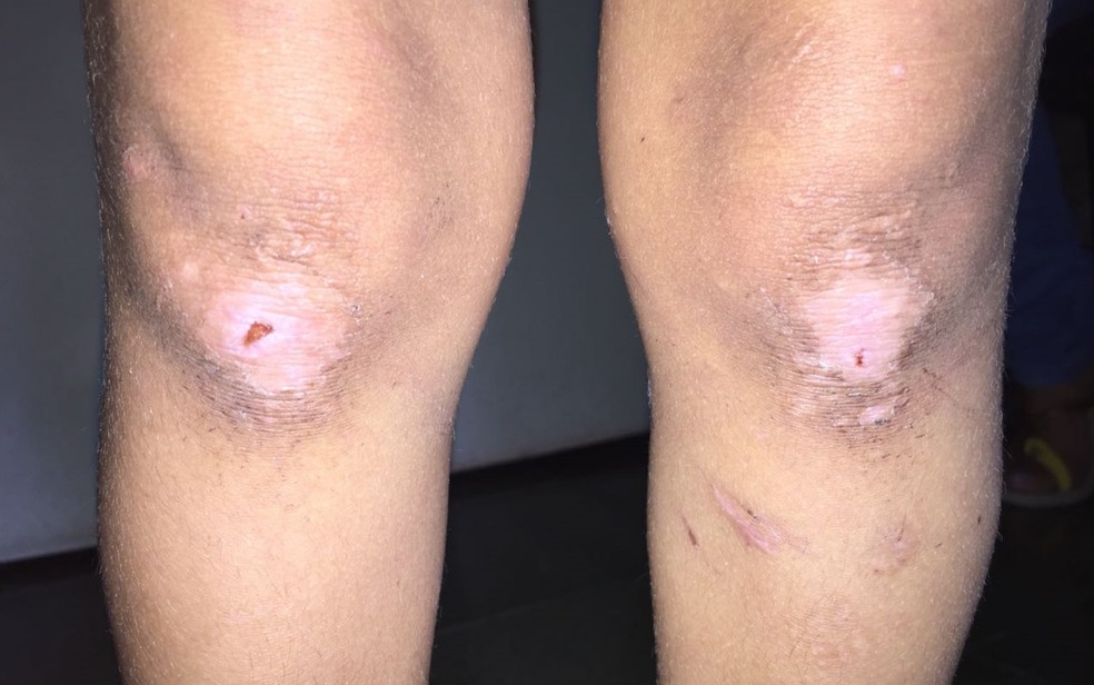 Segundo tia, crianÃ§a era obrigada a ficar de joelhos por horas como forma de castigo (Foto: PolÃ­cia Civi/DivulgaÃ§Ã£o)