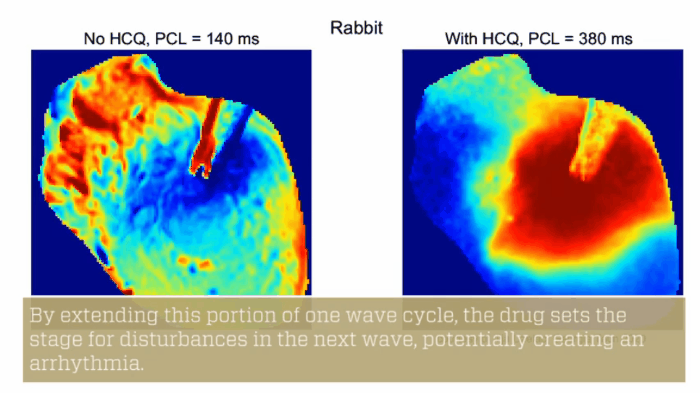Ondas cardíacas em coração de coelho sem hidroxicloroquina (esquerda) e com hidroxicloroquina (direita) (Foto: Georgia Tech)