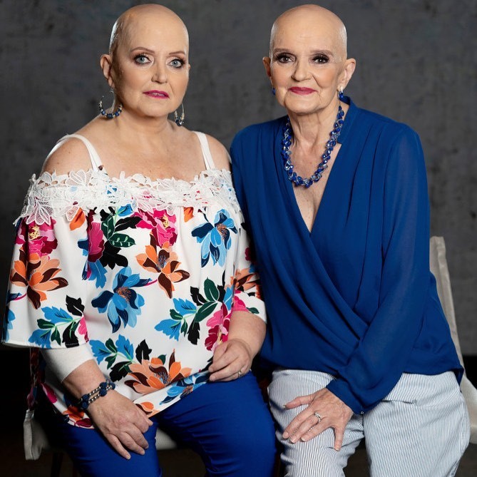 As irmãs Linda e Anne Nolan (Foto: Reprodução Instagram / The Sun)