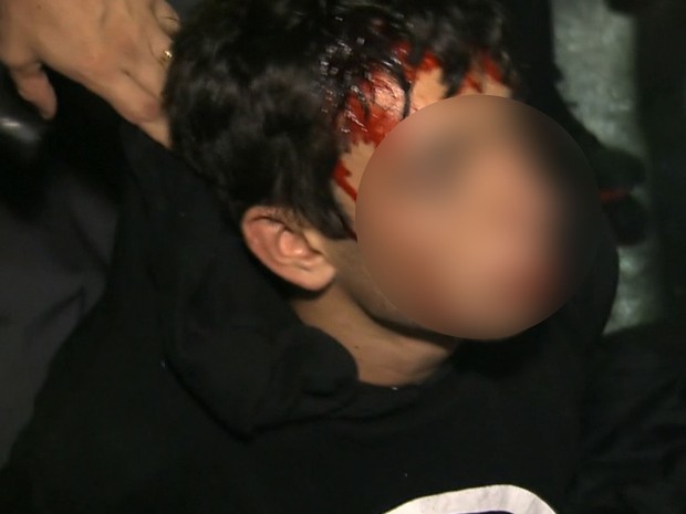 Manifestante ferido e detido pela PM MPL (Foto: Reprodução/TV Globo)
