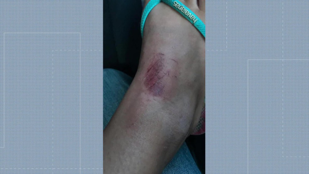 Mãe e filha ficaram feridas após briga por causa de cão na Barra da Tijuca, na Zona Oeste do Rio — Foto: Reprodução/ TV Globo