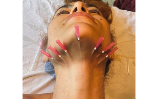 Eva Mendes choca ao mostrar tratamento estético com agulhas: "Torturada"
