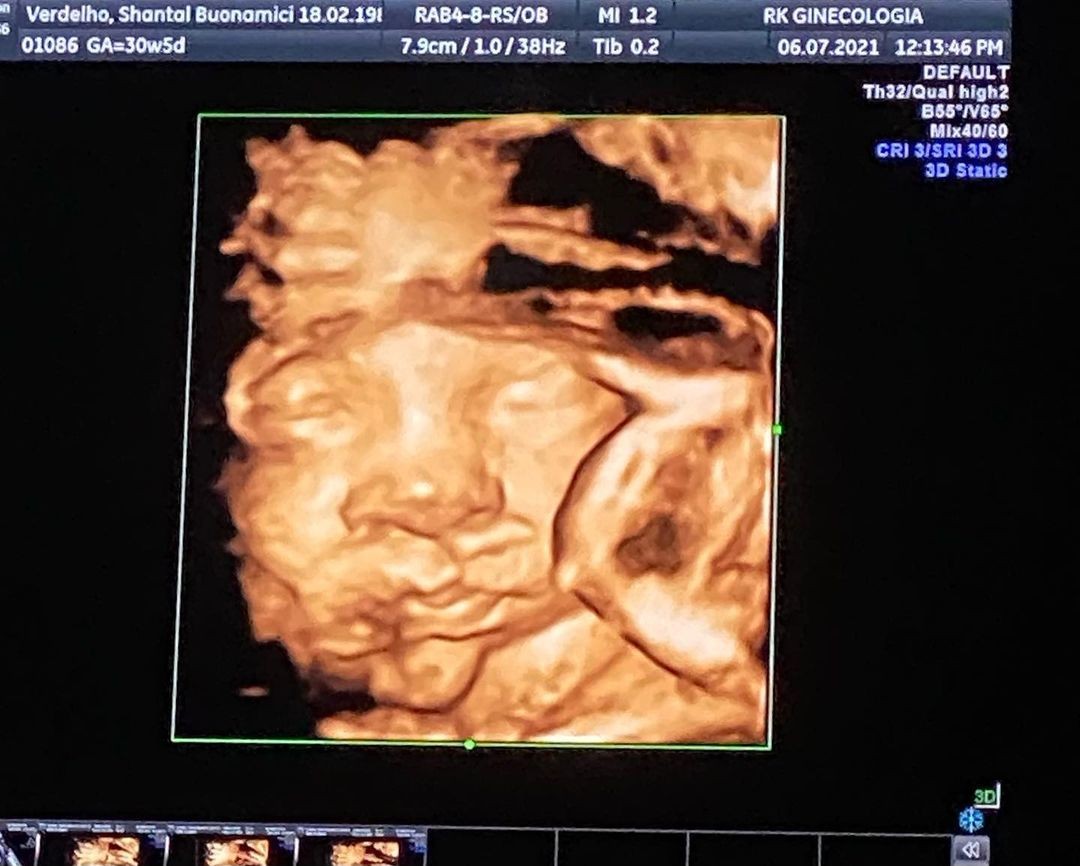 Shantal mostra foto de ultrassom e faz mistério: "baby boy ou baby girl?" (Foto: Reprodução/Instagram)