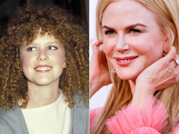 Nicole Kidman – 1983 | 2017 (Foto:  Getty Images)