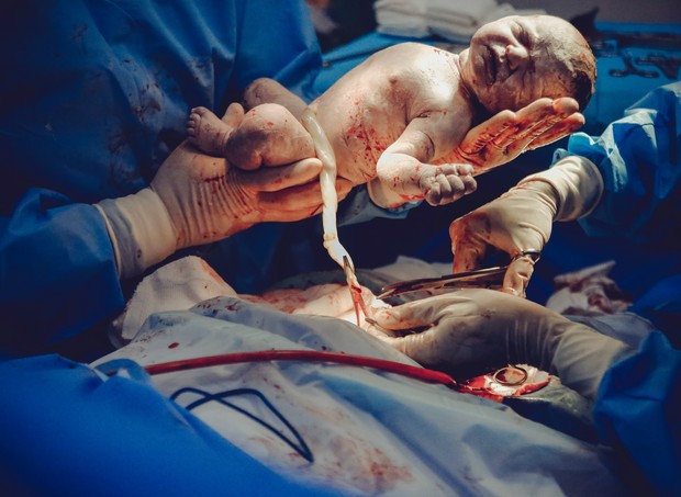 Foto ilustrativa de bebê após o nascimento (Foto: Pexels)