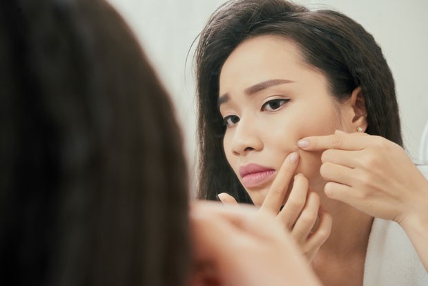 A acne adulta pode surgir por questões hormonais ou ainda pelo estresse ou alimentação (Foto: Thinkstock)