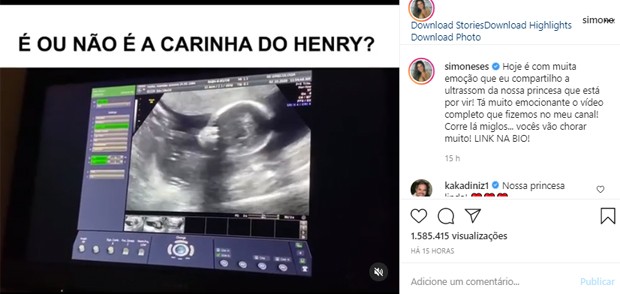 Simone faz ultrassom da segunda gravidez (Foto: Reprodução/Instagram)