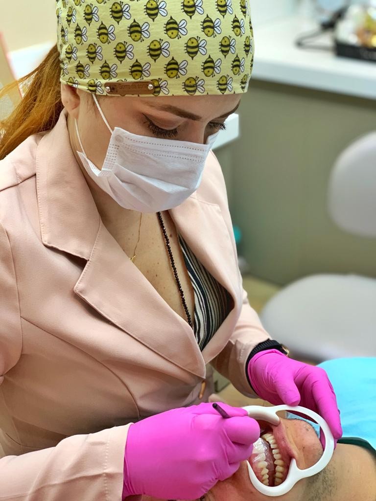 Lentes de contato dentais podem melhorar a mastigação, diz especialista que atua no Pará; veja dicas