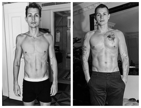 Fotos compartilhadas pelo músico James McVey antes e depois de seu tratamento contra anorexia (Foto: Instagram)