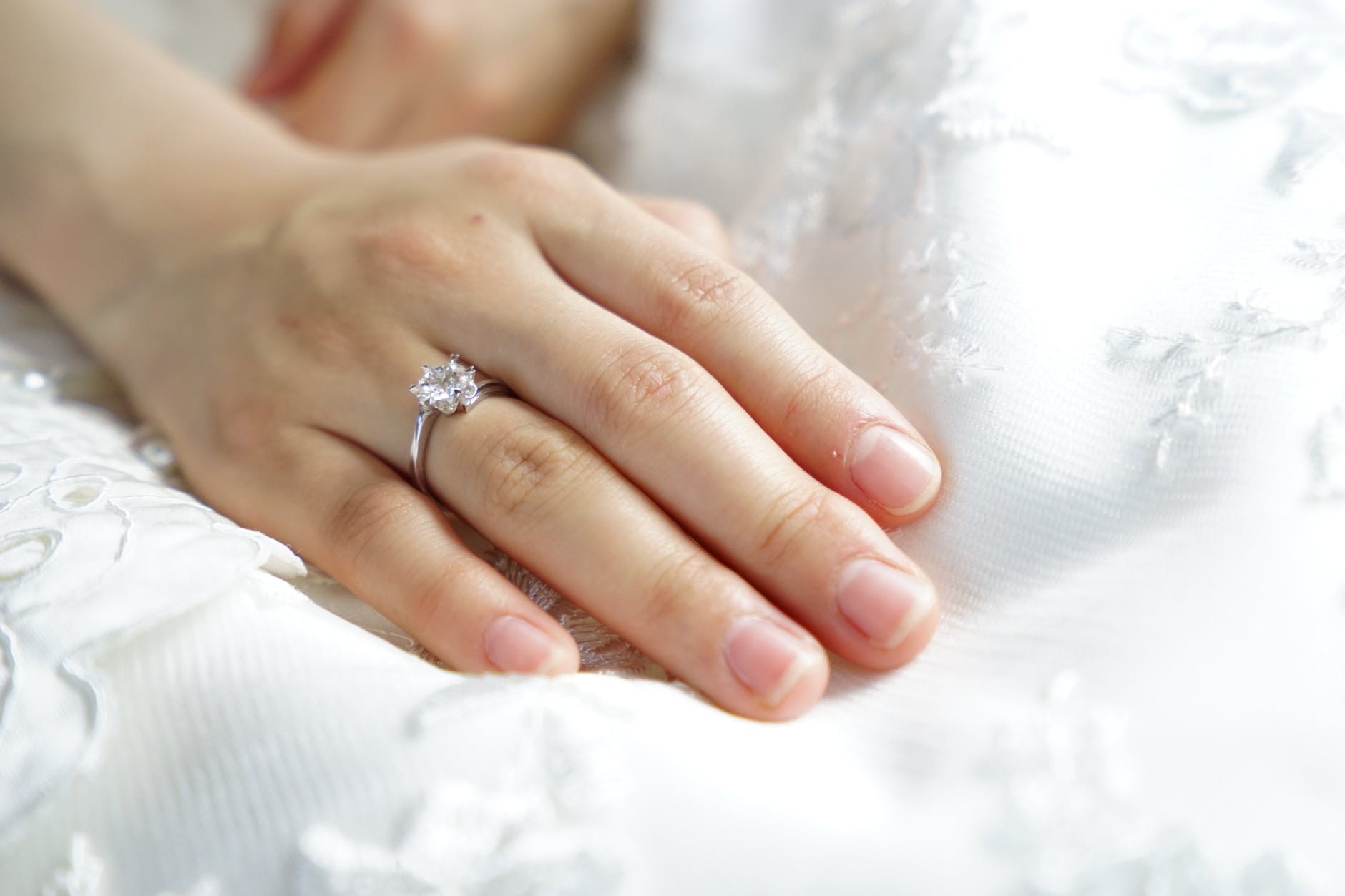 Mulher ficou com o dedo inchado após usar anel de casamento  (Foto: Pexels)