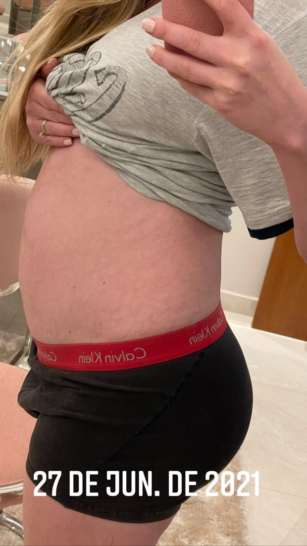 Bárbara Evans mostra evolução de barriga durante tratamento par engravidar (Foto: Reprodução Instagram)