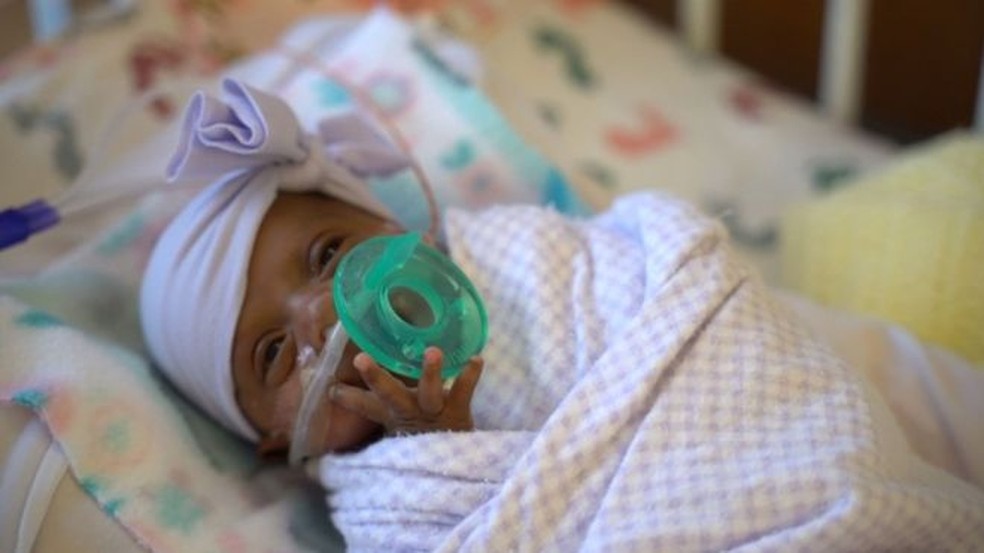 Saybie, que nasceu com 245 gramas, recebeu alta do hospital apÃ³s cinco meses de cuidados intensivos â€” Foto: AFP