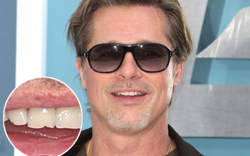 Brad Pitt chega com dente lascado na première do filme 'Trem-Bala'