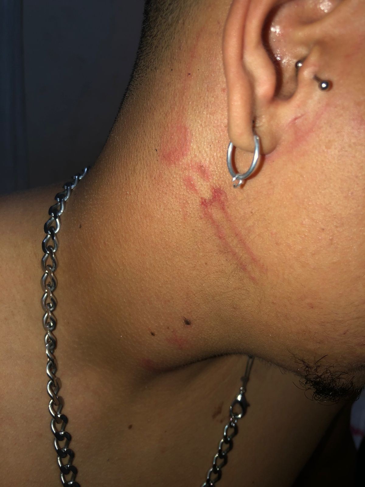 Motoboy faz entrega de lanche e acaba agredido por morador de prédio em BH