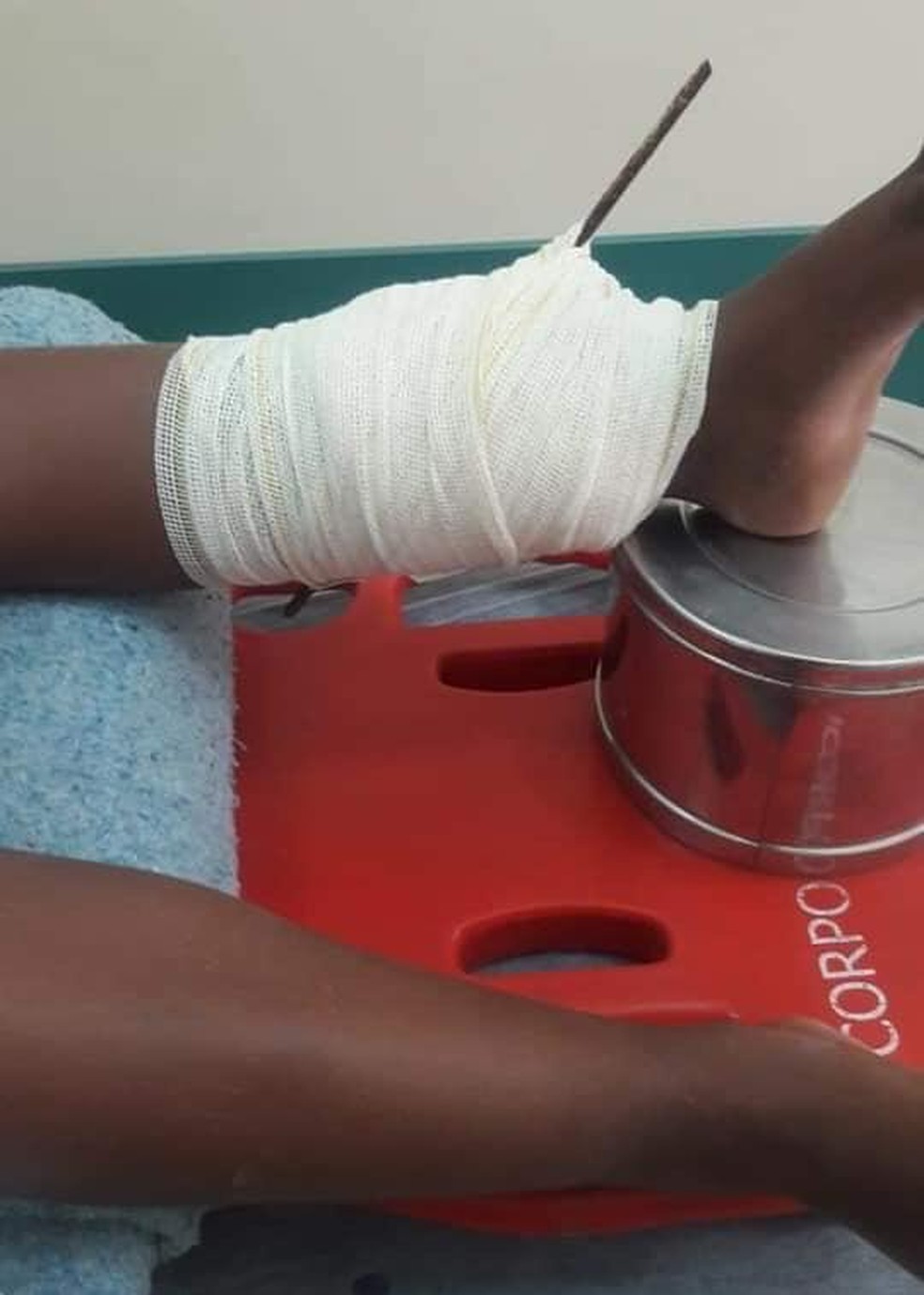 Menino Tem Perna Perfurada Por Ferro Apos Cair Em Buraco De Obra Durante Campeonato De Pipas Sao Jose Do Rio Preto E Aracatuba G1