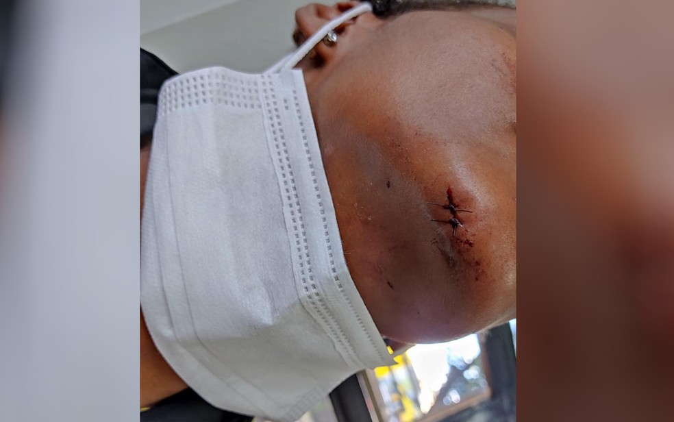 Mulher teve apenas um corte no queixo após esposo agredi-la e colocar fogo na casa do casal, em Goiânia — Foto: Polícia Militar/Divulgação 