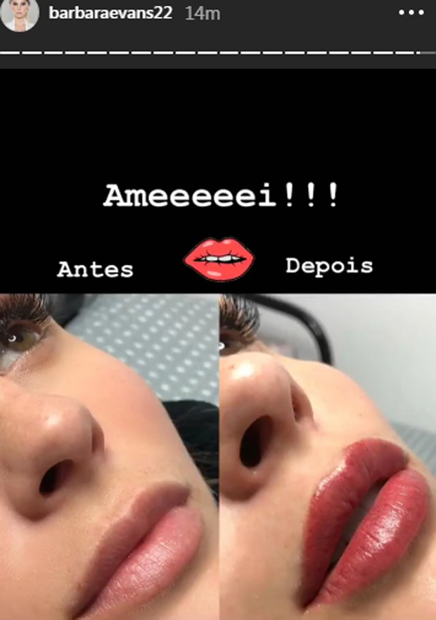 Bárbara Evans fez micropigmentação nos lábios (Foto: Reprodução Instagram)