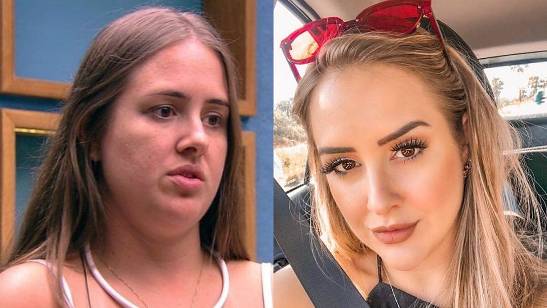 Patrícia Leitte posta antes e depois do rosto: 