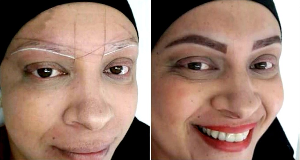 Procedimento oferecido de forma gratuita refaz a sobrancelha de mulheres em tratamento contra o câncer em Bauru — Foto: Arquivo pessoal