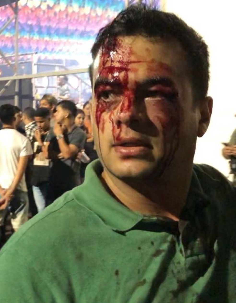 Murilo de Paula, de 32 anos, com o rosto sangrando no Pátio do Forró, em Caruaru — Foto: Reprodução/WhatsApp