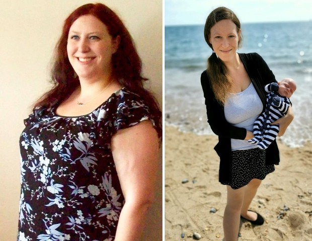 Antes e depois de Michelle sofrer com hiperêmese gravídica (Foto: Reprodução/Mirror)