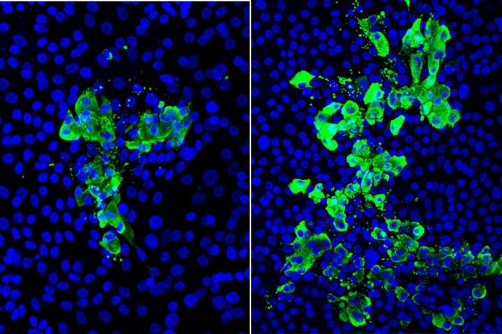 Imagens de modelos de tecido de vias aéreas com núcleos celulares (azul) e células infectadas com o vírus SARS-CoV-2 (verde); o tecido exposto à fumaça do cigarro (à direita) tinha 2 a 3 vezes mais células infectadas do que o outro (Foto: Centro de Pesquisa de Células-Tronco Broad UCLA)