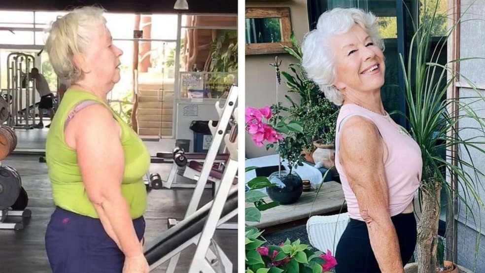 Joan antes e depois — Foto: Reprodução/Instagram