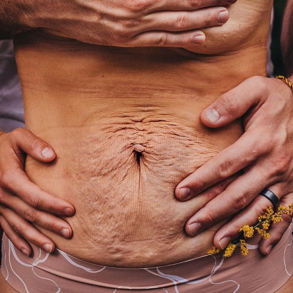 Девушки до и после родов. Что делать если после родов сильно. Похудение после родов. Живот после родов по неделям. Фигура после родов.