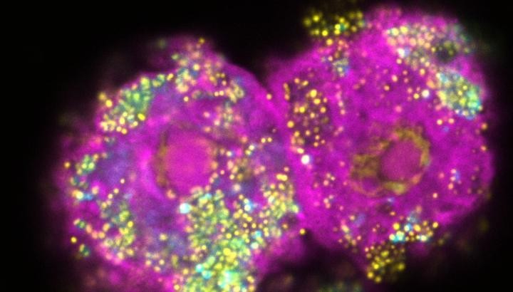 Duas amebas (rosa) são infectadas por bactérias do gênero chlamydia (amarelo/azul) (Foto: Patrick Arthofer)