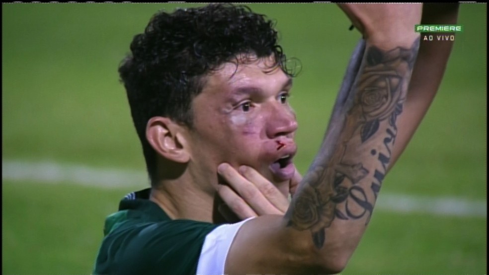 Júnior Viçosa após ser atingido no lance do gol (Foto: Reprodução/Premiere)
