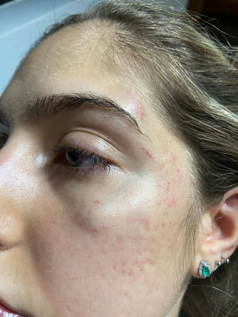 Gabriela Campos Duarte Machado, 22 anos, após agressão sofrida pelo ex-namorado, em BH — Foto: Arquivo pessoal