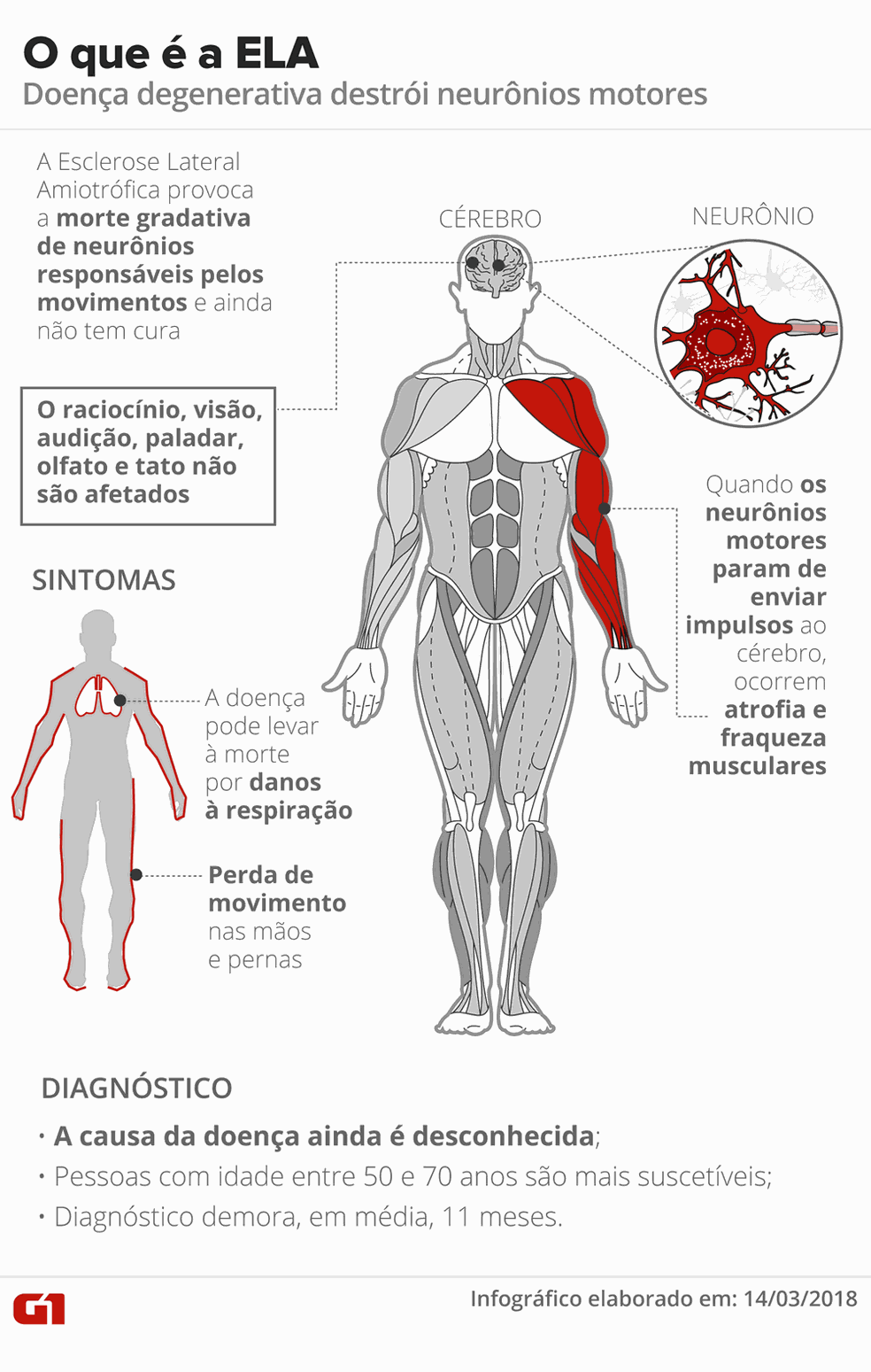 Esclerose Lateral Amiotrófica  — Foto: Infografia: Karina Almeida/G1