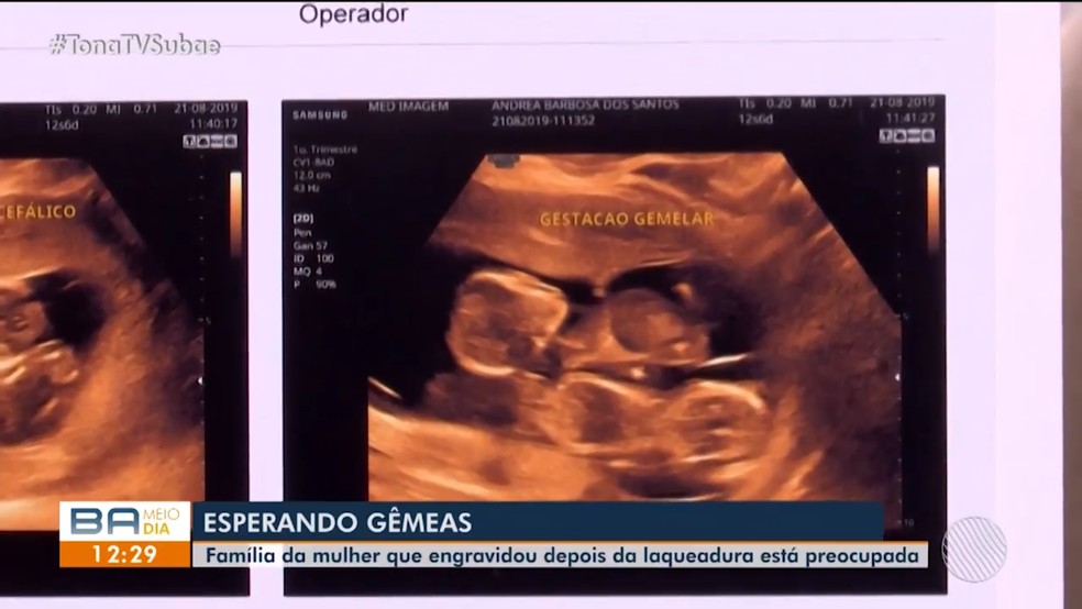 Lavradora que engravidou um ano após laqueadura na Bahia vai ter gêmeos — Foto: Reprodução/TV Subaé