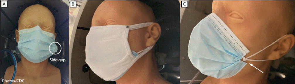 Imagens de exemplo do CDC mostram como reduzir as folgas (que aparecem na figura A) na máscara de procedimentos (figura C) e como combiná-las (na figura B) para diminuir a chance de contágio pelo coronavírus. — Foto: Reprodução/CDC