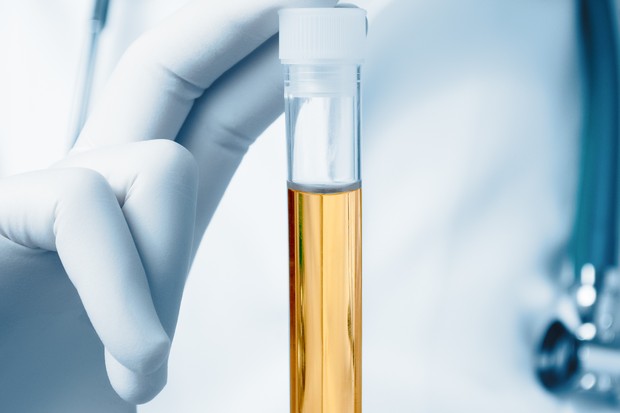 Exame de urina ajuda a detectar câncer de próstata com mais precisão (Foto: Thinkstock)